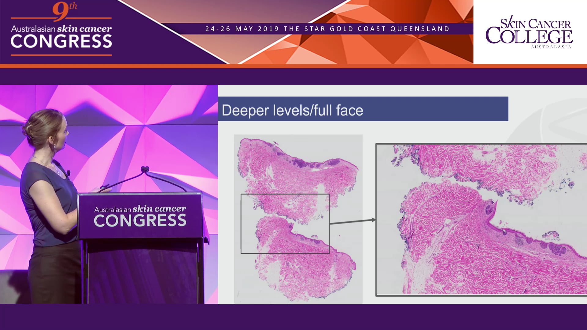 Understanding the language of histopathology Dr Sarah Wallace
