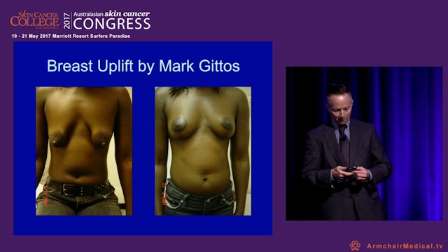 How to think like a cosmetic surgeon Dr Mark Gittos
