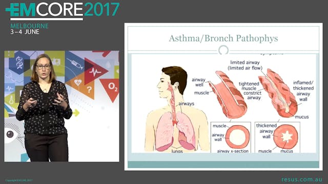 Paediatric respiratory - the myths an...