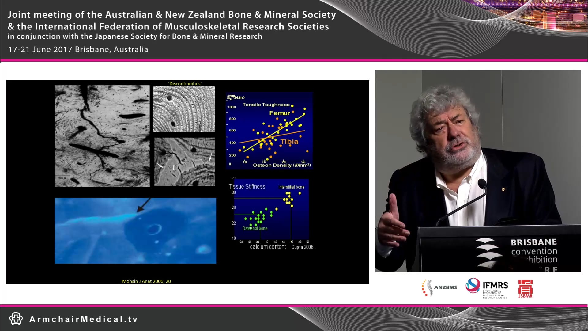 What is bone quality Prof Ego Seeman
