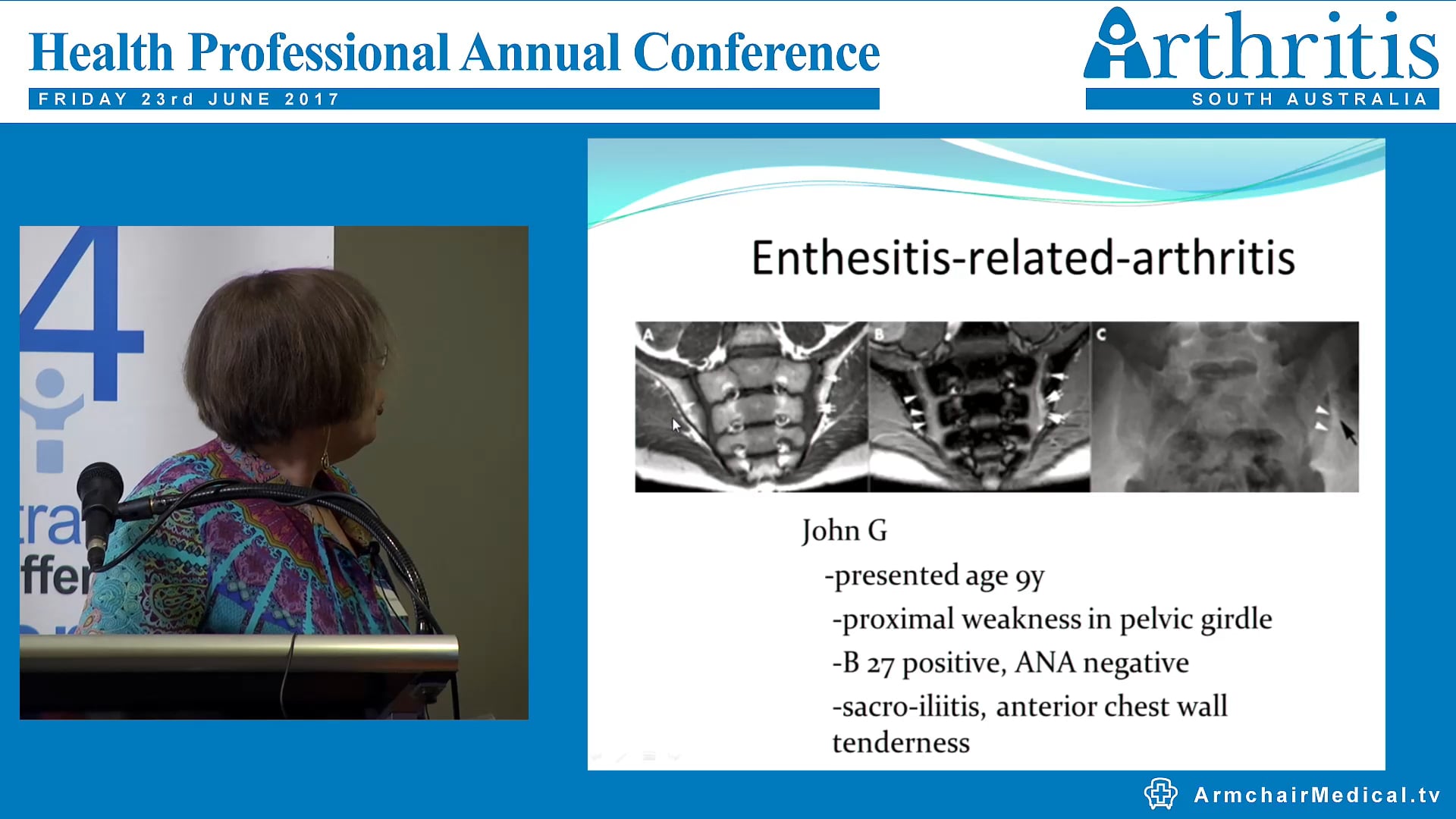 Juvenile Idiopathic Arthritis- management and research update Dr Christina Boros – Paediatric Rheumatologist