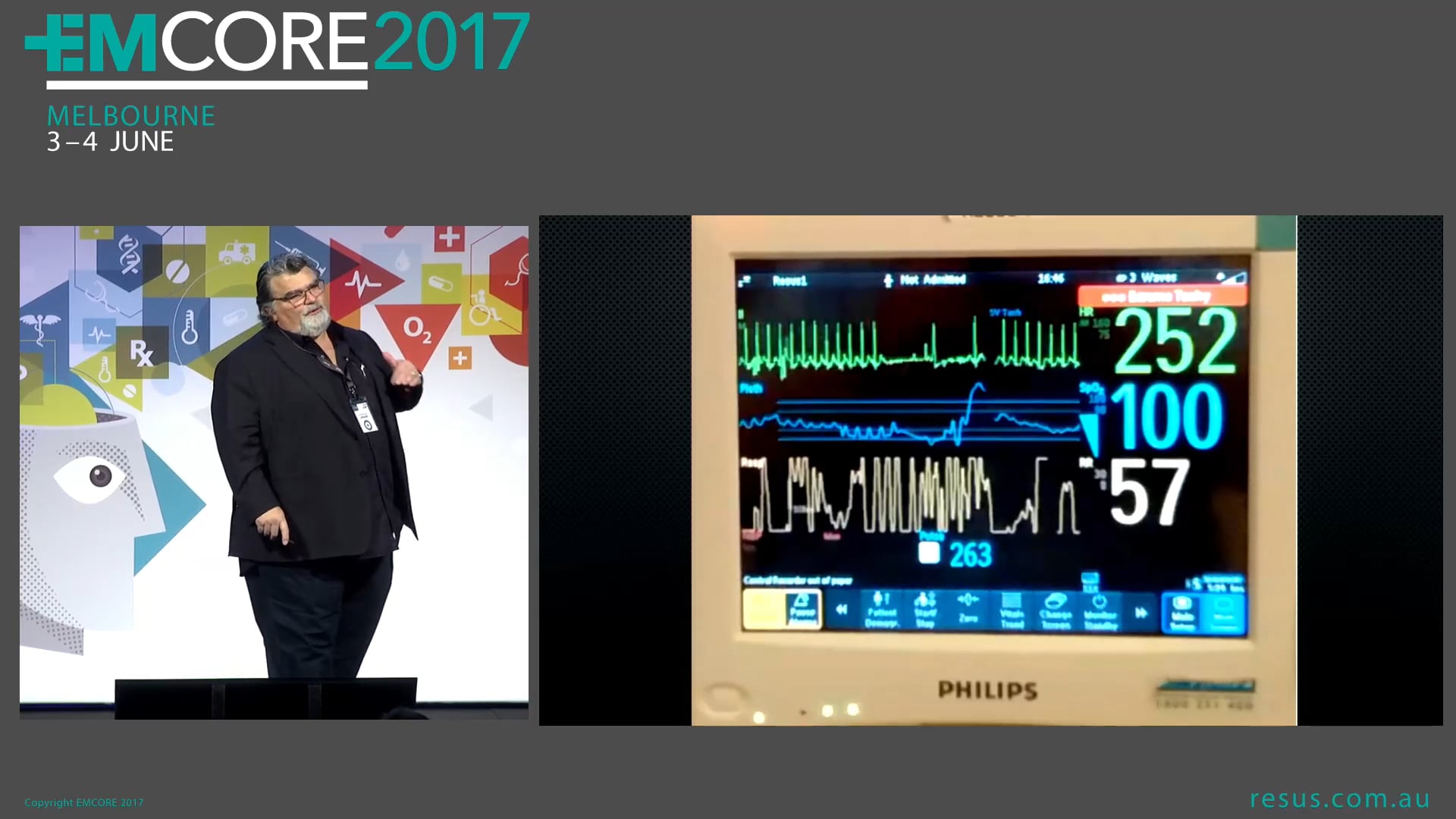 Paeds Pearls 2017 Assoc Prof Peter Kas