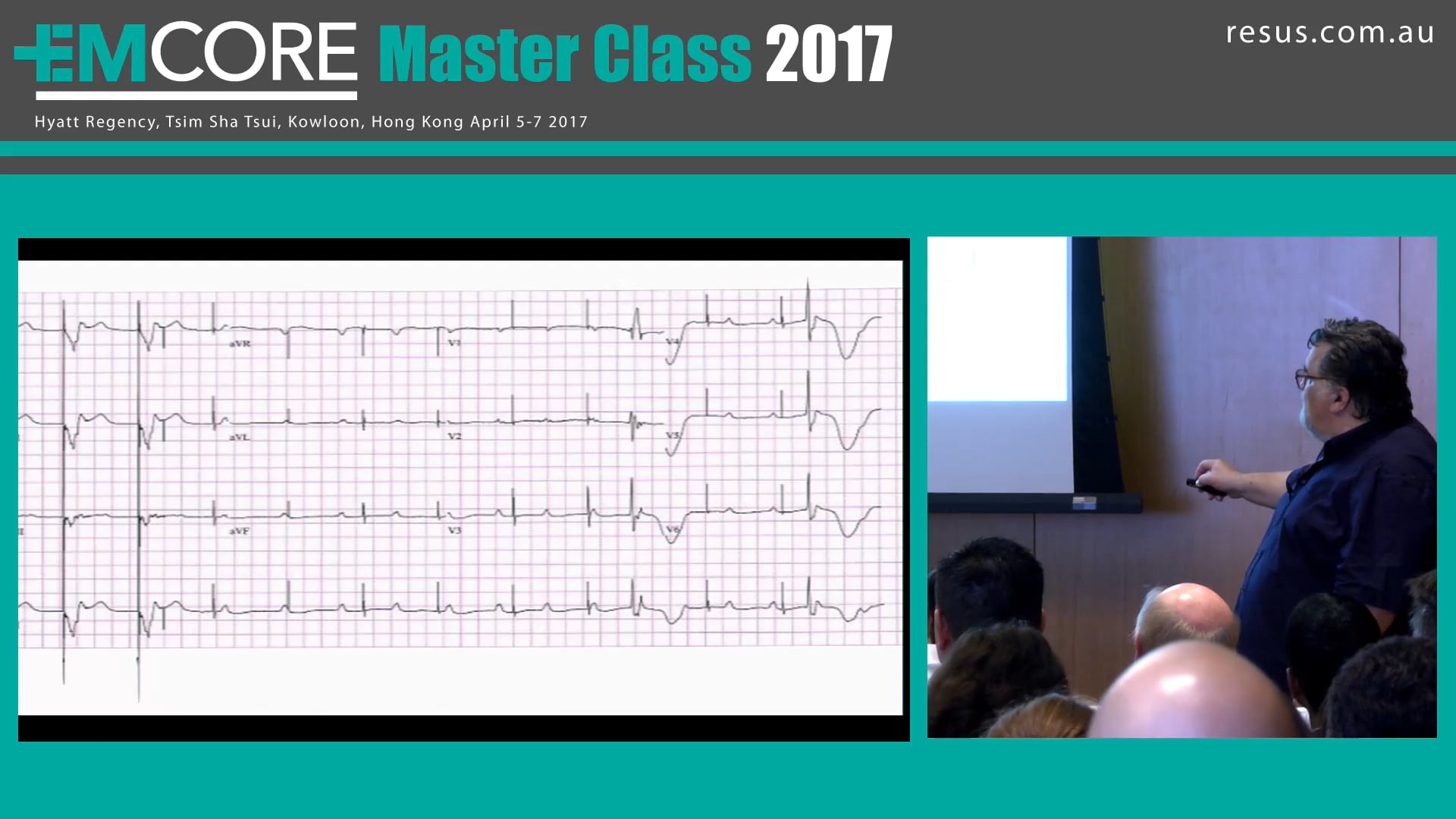 What Pacemaker is that Assoc Peter Kas