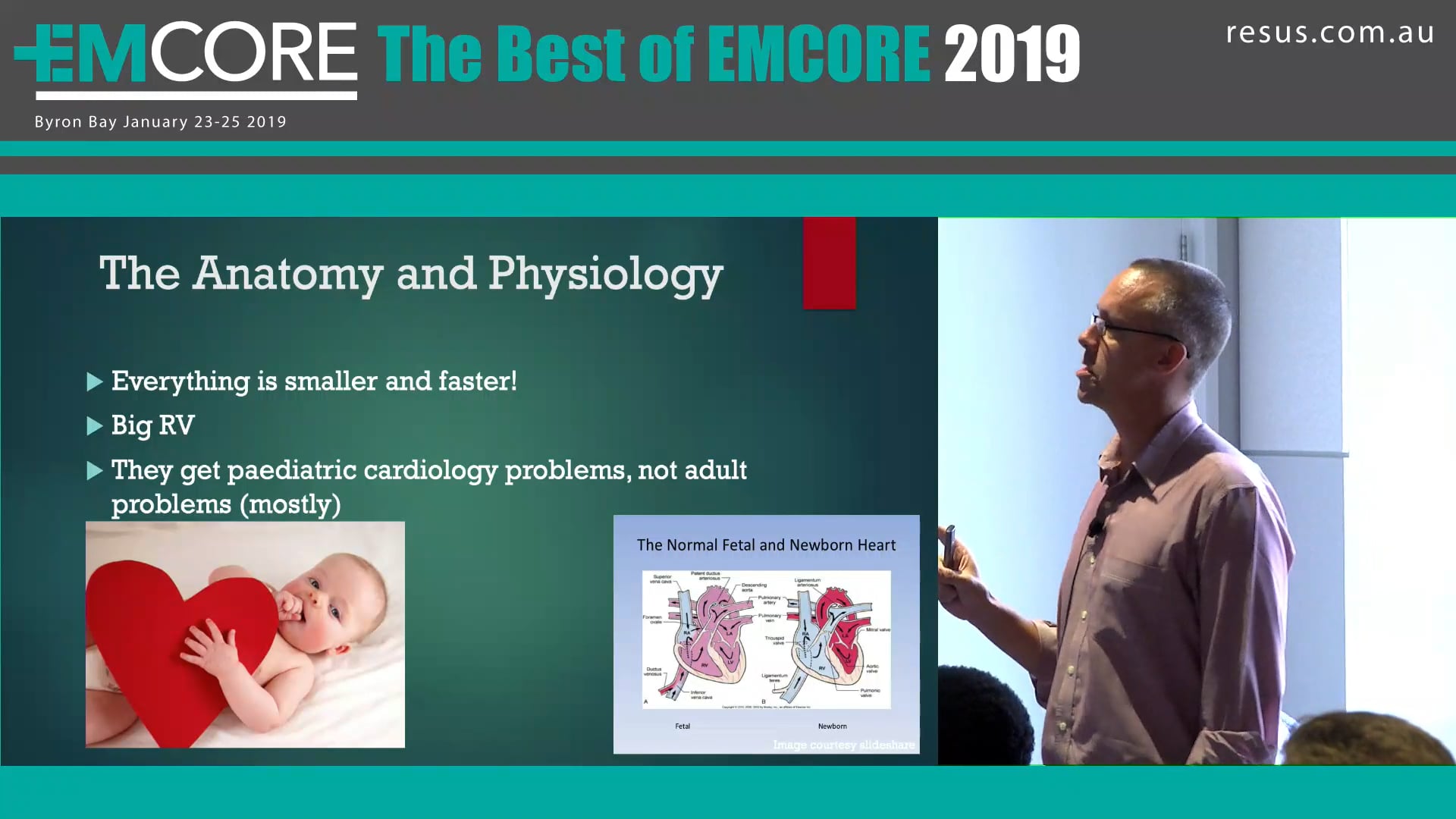 Paediatric ECG Adam Michael
