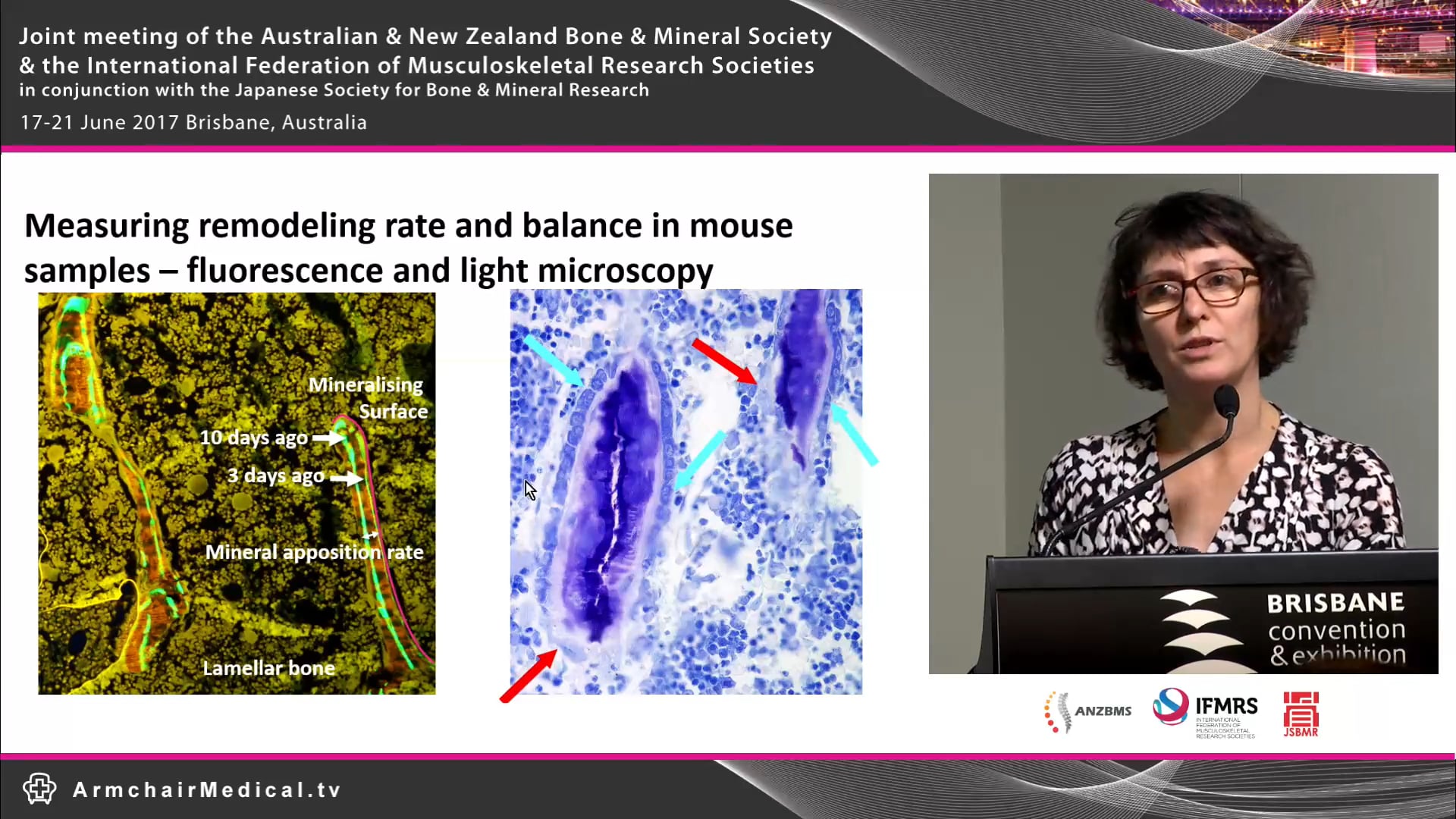 Bone histology Benefits, limitations and pitfalls Assoc Prof Natalie Sims