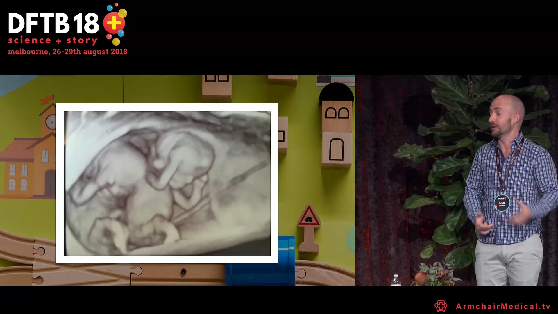 Joanne & Scott's little kingdom Being NICU parents Joanne & Scott Beedie