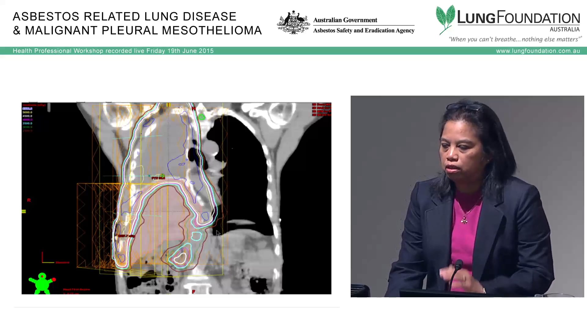 Mesothelioma Radiotherapy Dr Mo Mo Tin