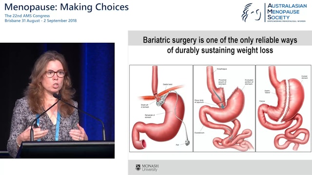 Bariatric surgery – positive and negative consequences Prof Wendy Brown