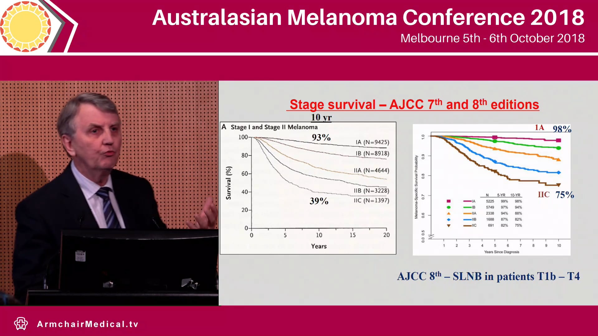 Sentinel Node Biopsy when should it be done Mark Smithers