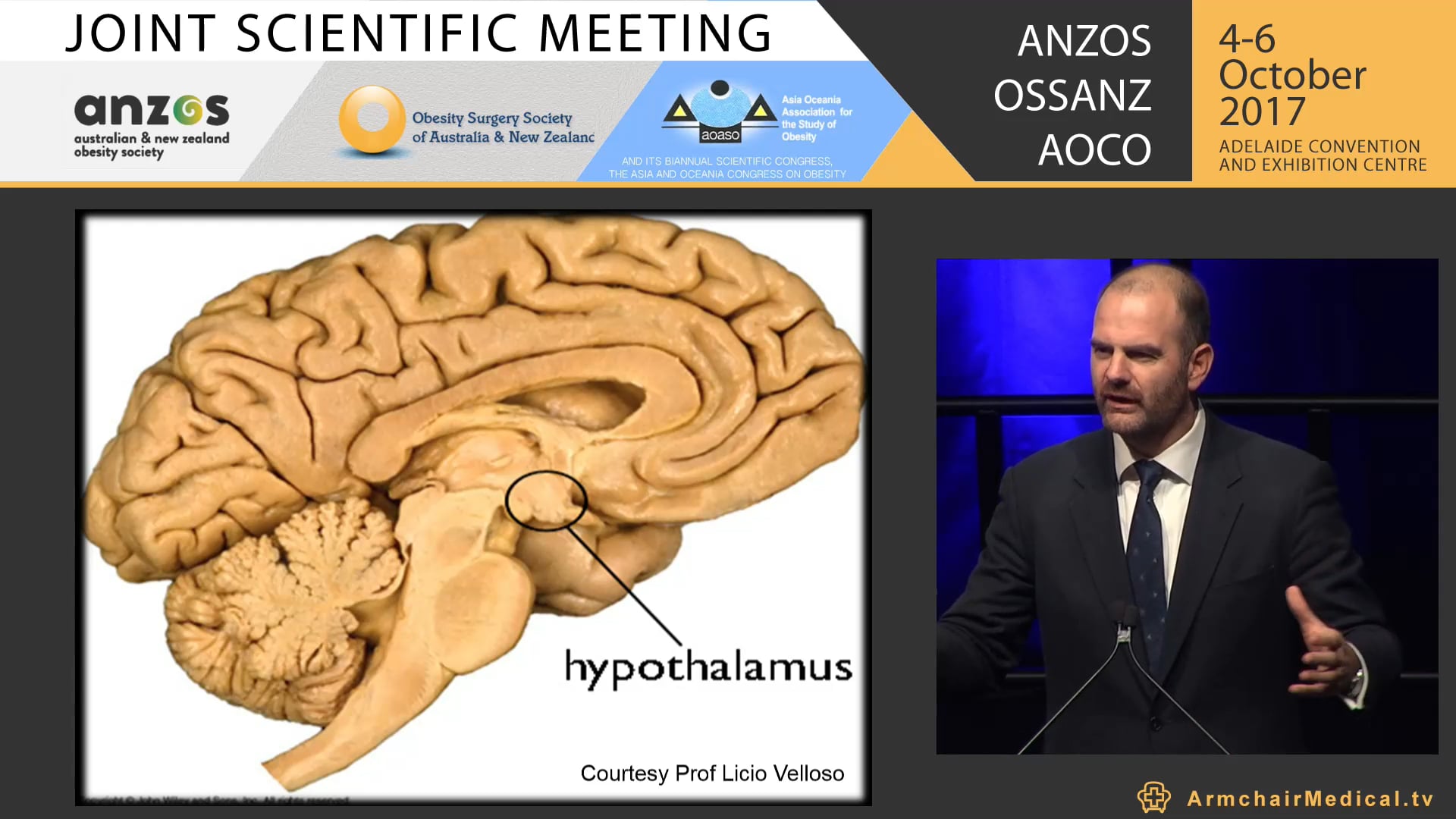 The modern metabolic clinic - interdisciplinarymultistage - Prof Carel Le Roux