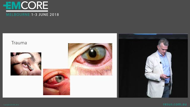 Sudden Visual Loss Assoc Prof Alastai...