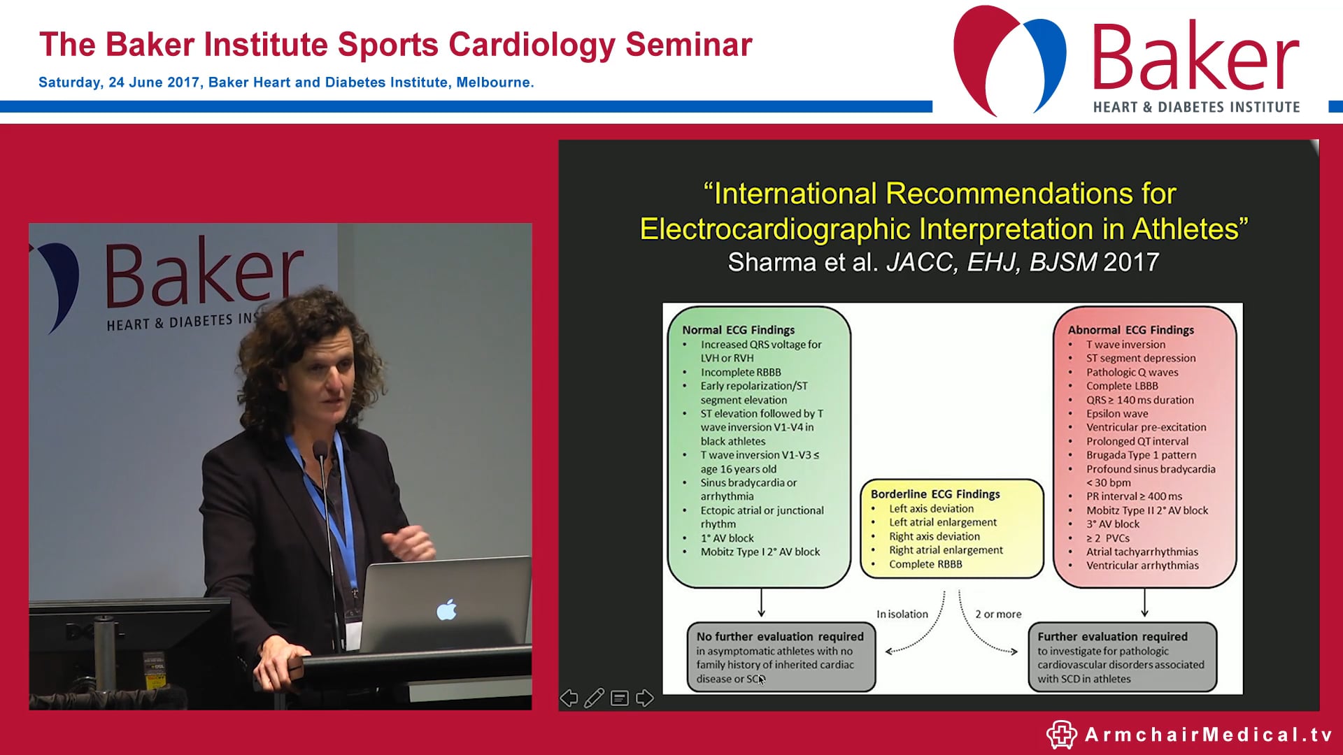 The Athlete's ECG Dr Maria Brosnan