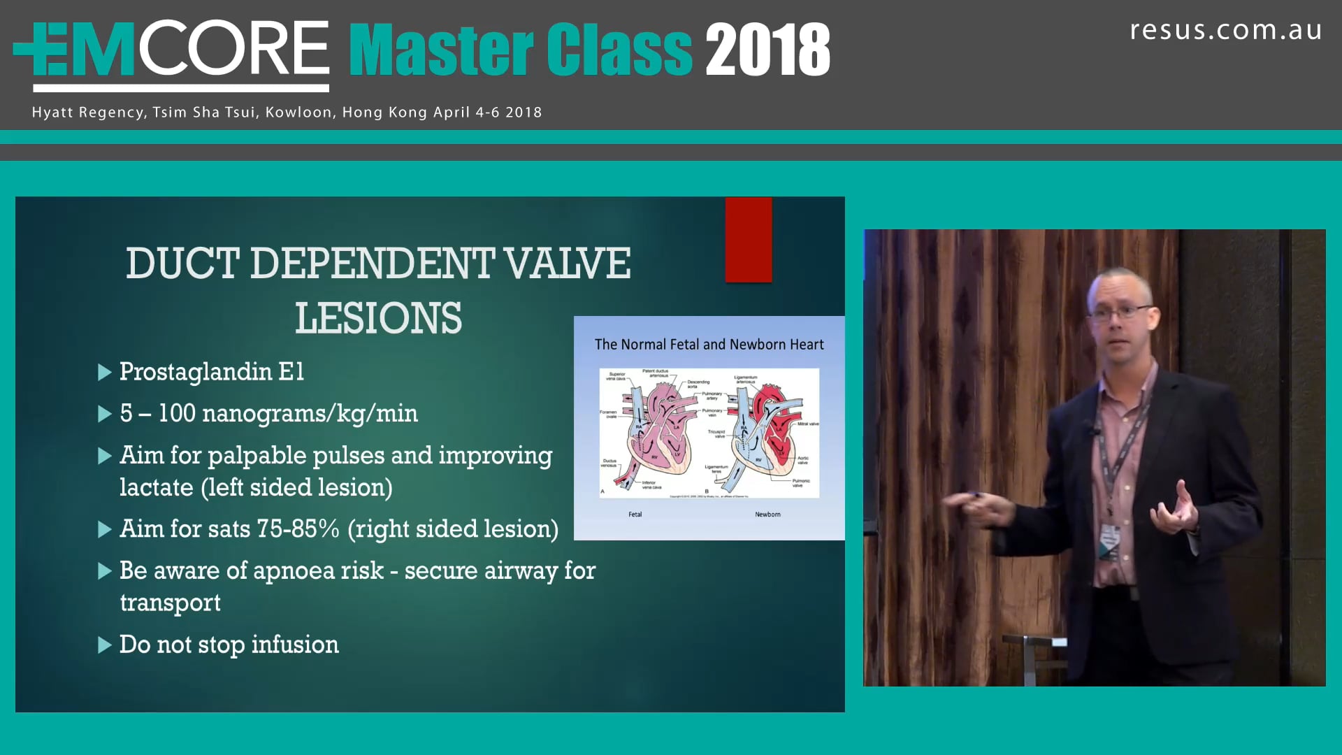 Paediatric Resuscitation A Case Dr Adam Michaels