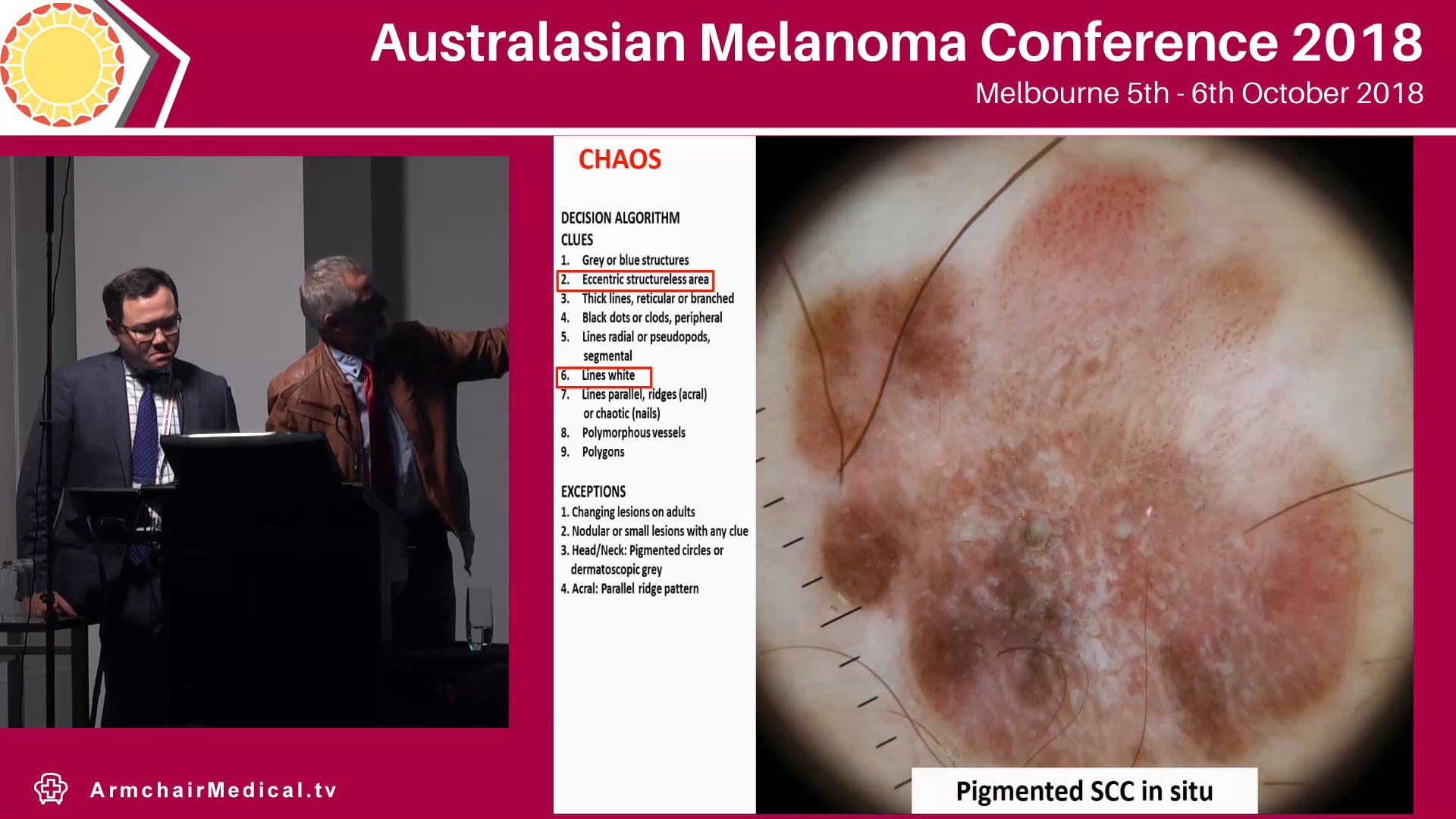 Interactive Dermoscopy Quiz Yan Pan