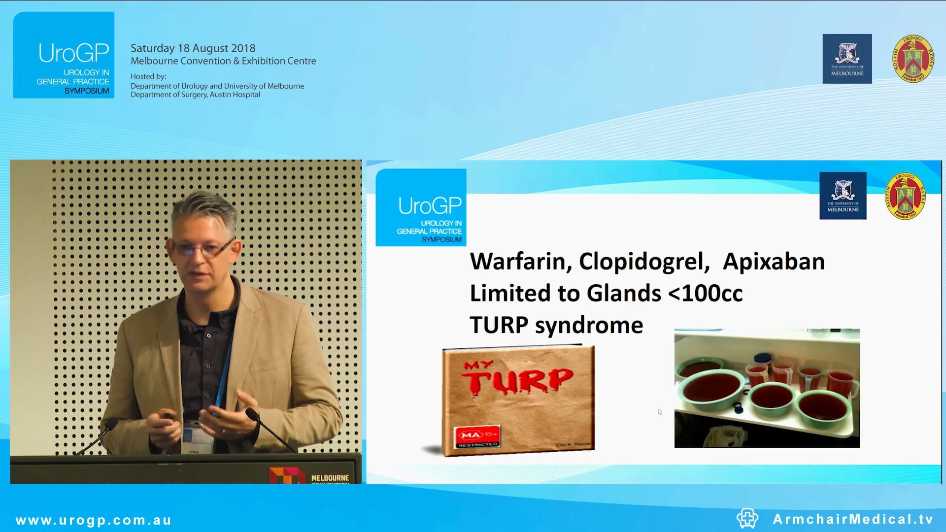 Greenlight laser Prostatectomy for the treatment of Benign Prostatic Hyperplasia, Mr Dennis Gyomber