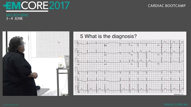 ECG Quix Answers