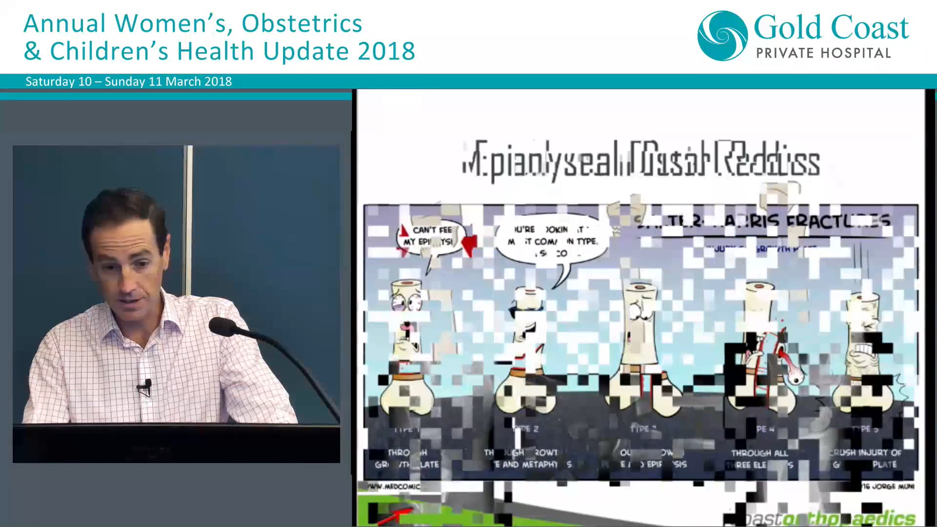 Common paediatric fractures Dr Lochlin Brown, Orthopaedic Surgeon