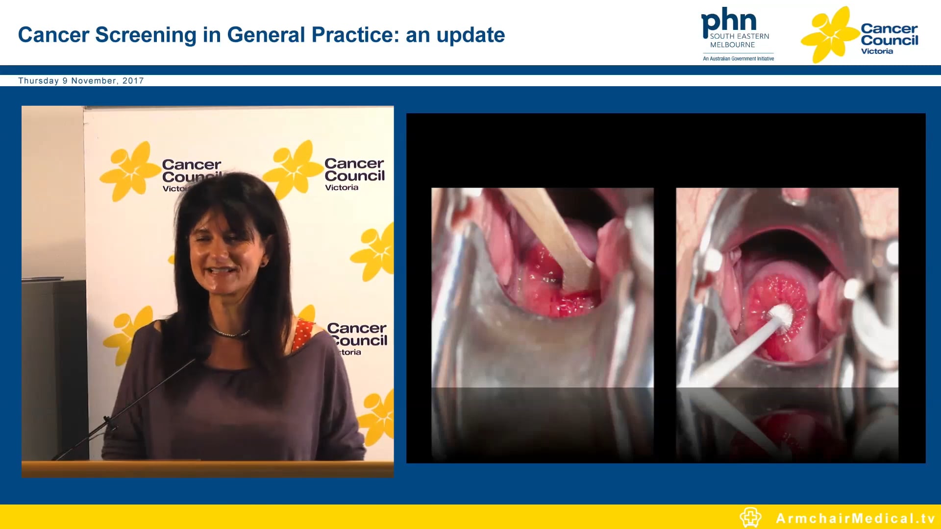 The New National Cervical Screening Program and New NHMRC Clinical Guidelines for Colorectal Cancer