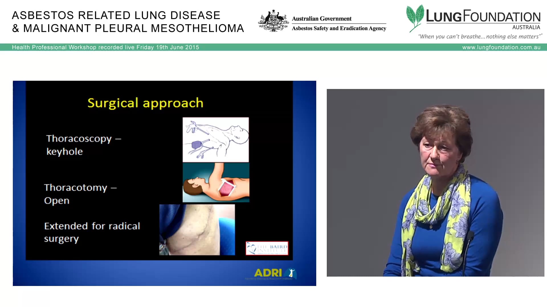 Mesothelioma Surgery – VAT Pleurodesis, EPP Jocelyn McLean