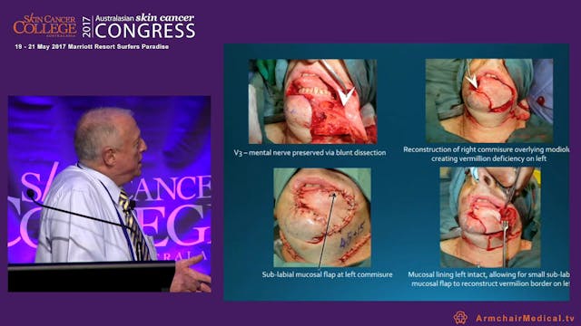 Wound management of the lower limb A ...