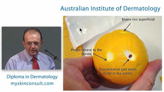 Skin Biopsies Dr. Ian McColl John Fly...