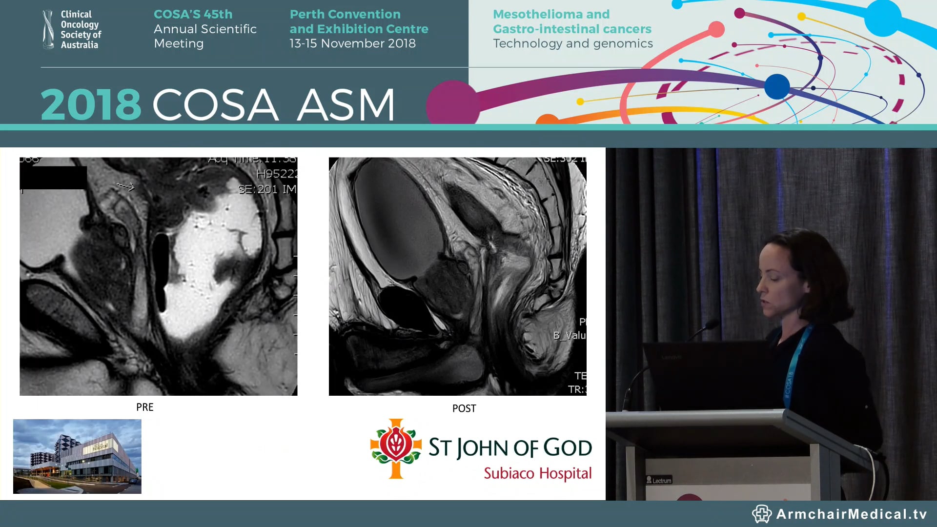 Colorectal Surgery and Stoma Formation - Jennifer Ryan