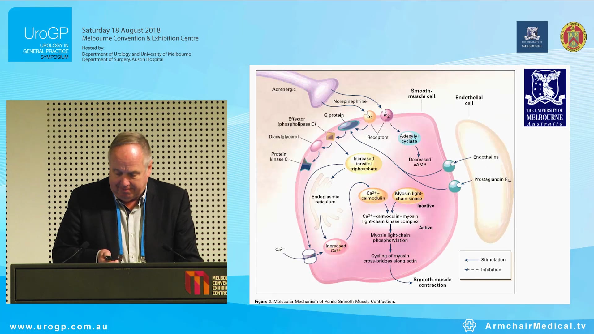 Impotency, Premature ejaculation, Peyronie's disease Dr Michael Chamberlain