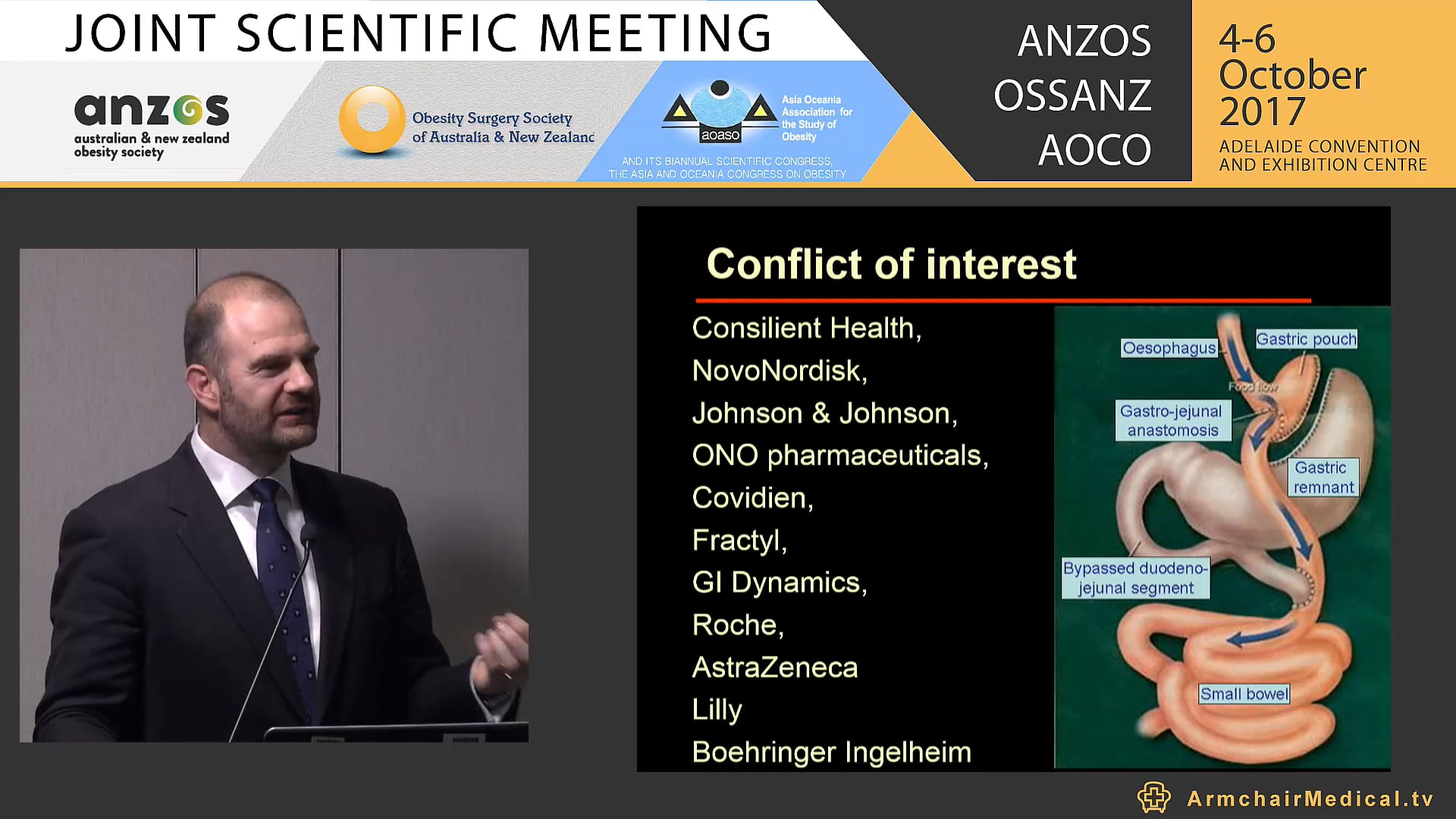 Pharmacotherapy as the next step after lifestyle Prof Carel le Roux