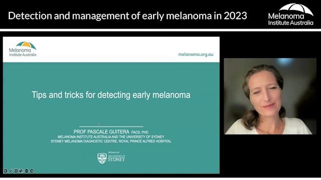Tips and tricks for detecting early melanoma – Prof Pascale Guitera (Dermatologist)