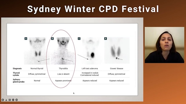 Evaluation of Thyroid Disease Dr Divya Namboodiri