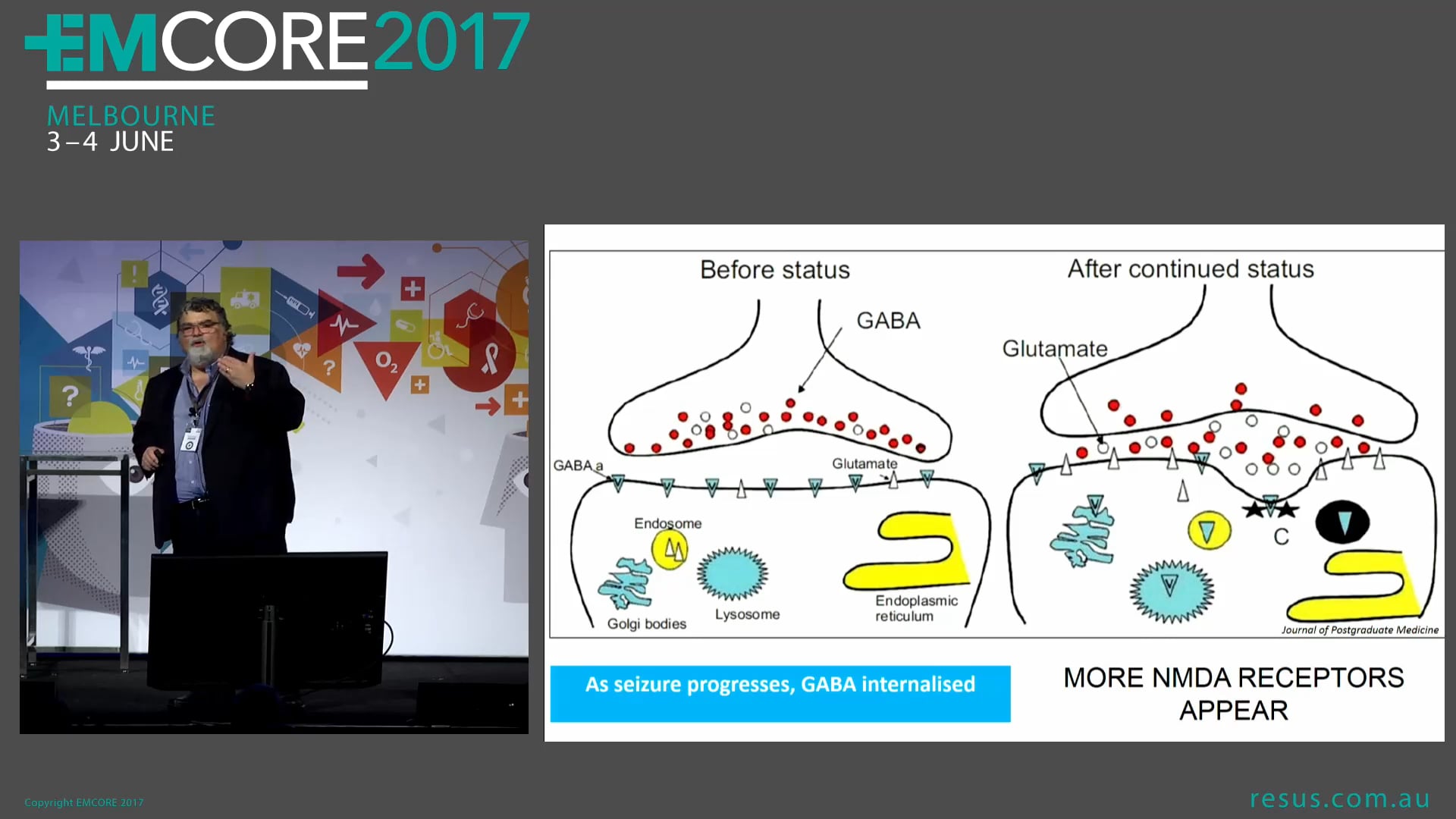 Refractory Status Epilepticus Get the Ketamine Assoc Prof Peter Kas