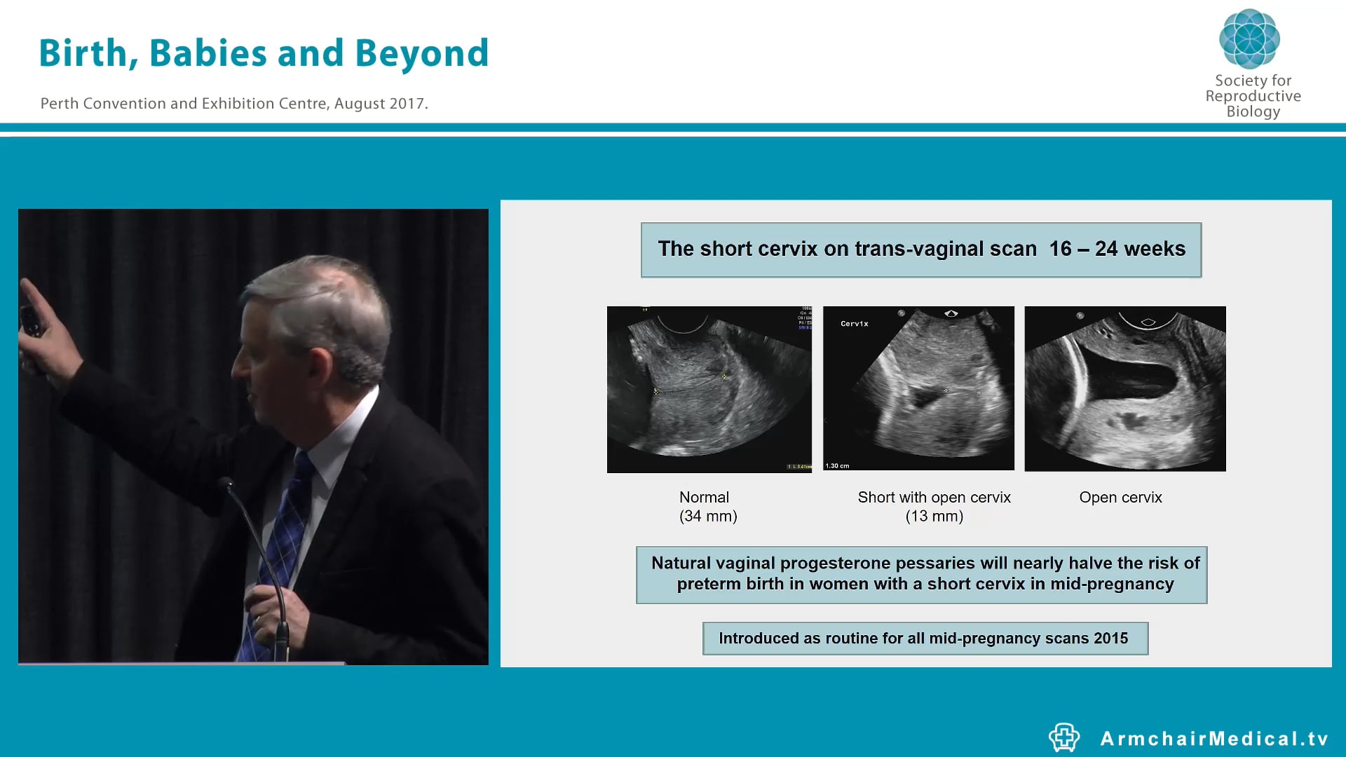 Preventing Preterm Birth in Western Australia John Newman