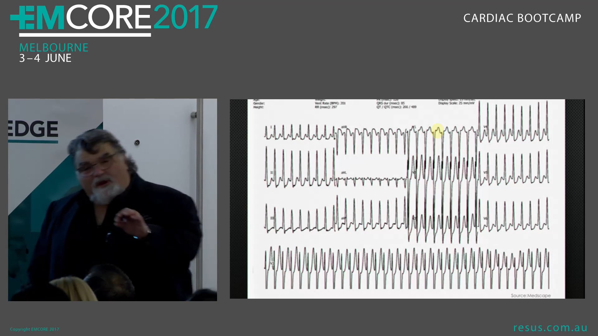Narrow Complex Assoc Prof Peter Kas