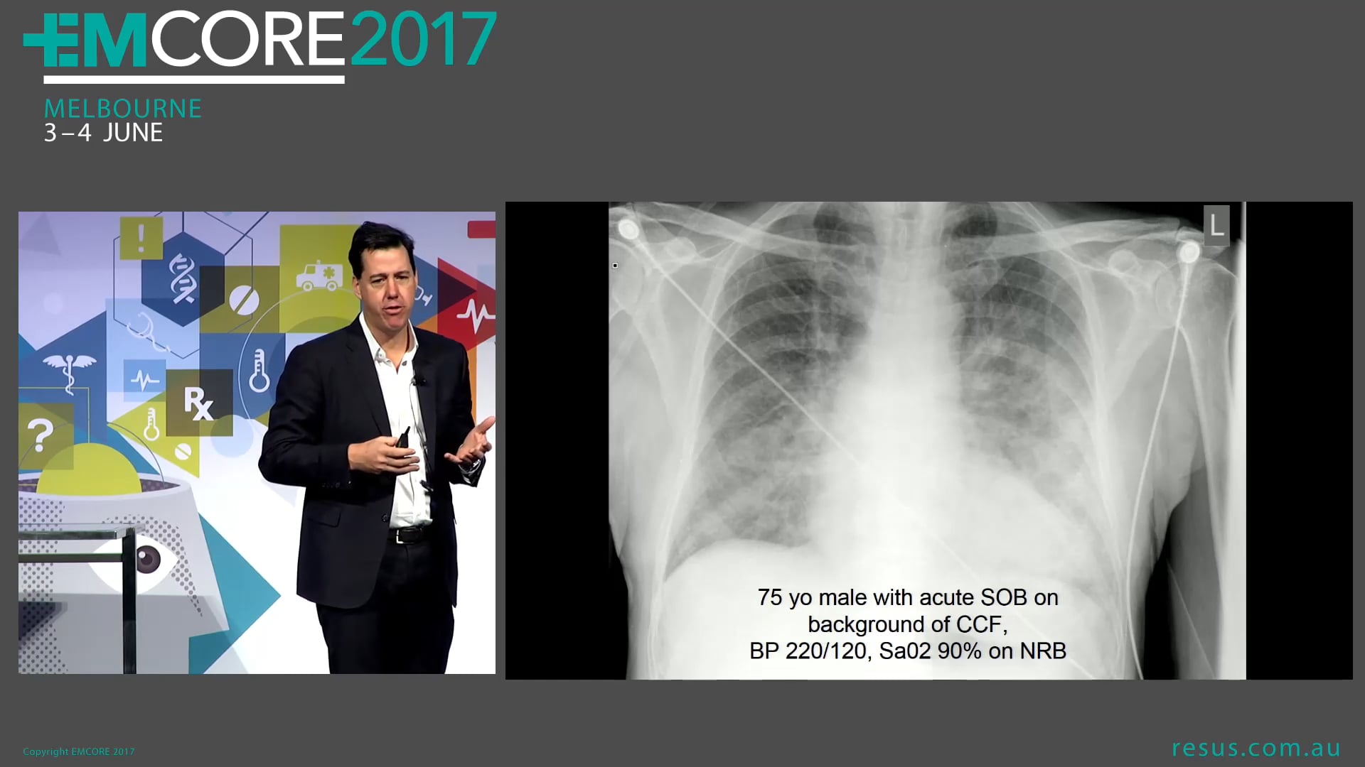 BiPAP How to use it like a pro Dr James Edwards Co-Director ED RPA Sydney