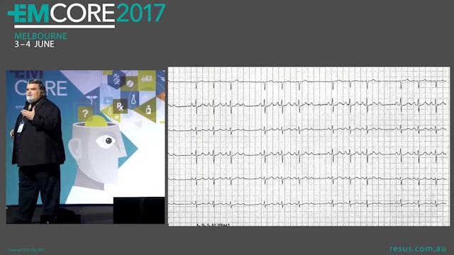 Rule the Arrhythmia Assoc Prof Peter Kas