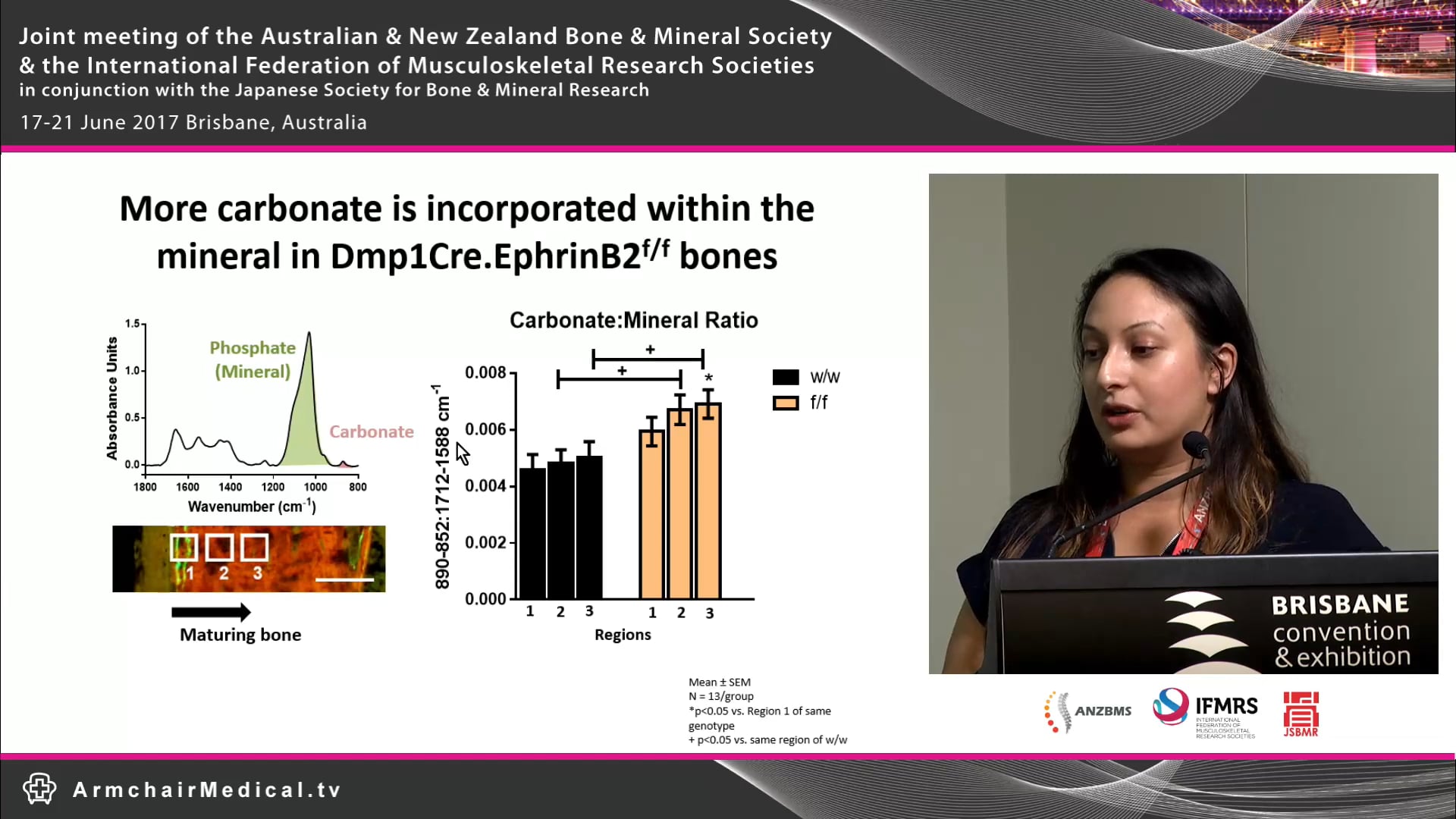 Fourier Transform InfraRed Spectroscopy imaging in bone What does it tell us Christina Vrahnas
