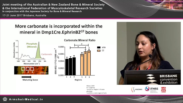 Fourier Transform InfraRed Spectroscopy imaging in bone What does it tell us Christina Vrahnas