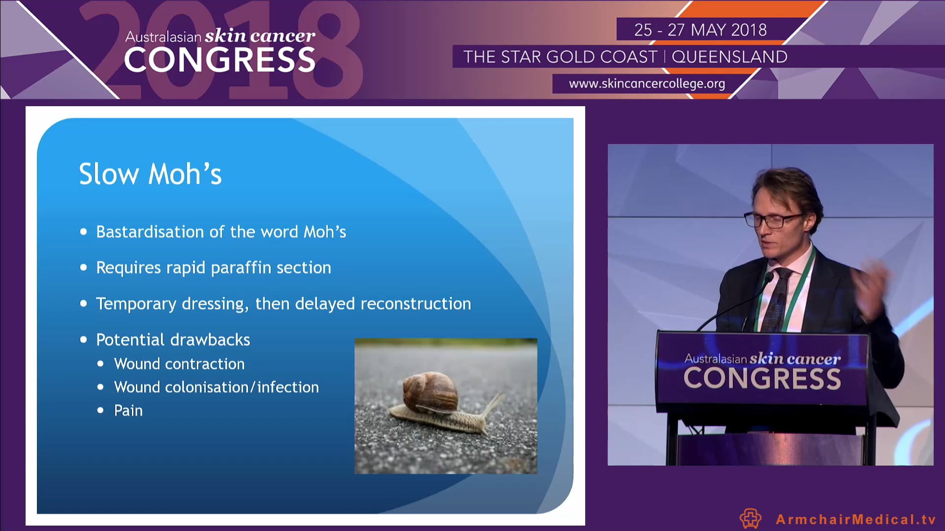 Concealing surgery for Lentigo Maligna Dr James Southwell-Keely