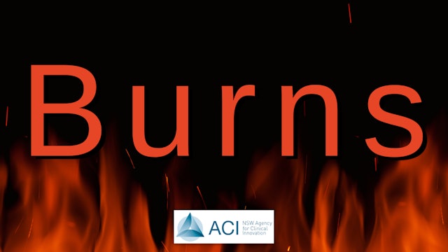 Agency for Clinical Innovation - Burns