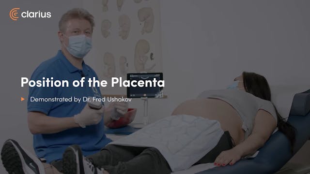 Position of the Placenta