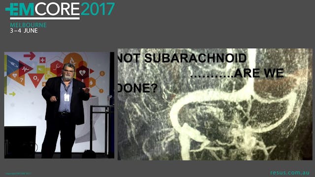 Headache - Not Subarachnoid Are we do...