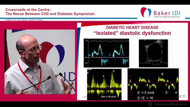 Mechanisms of impaired cardiac function in Type 2 Diabetes Prof Tom Marwick