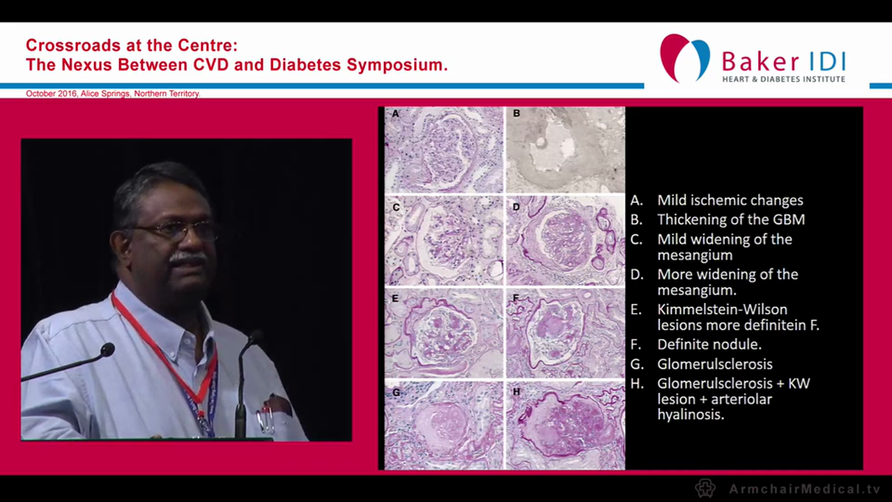 Renal complication of Diabetes Mellitus Dr Basant Pawar