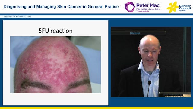 Solar keratoses Which treatments to u...