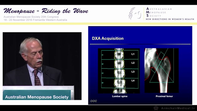 Interpreting DXA Scans Pitfalls and problems Michael McClung