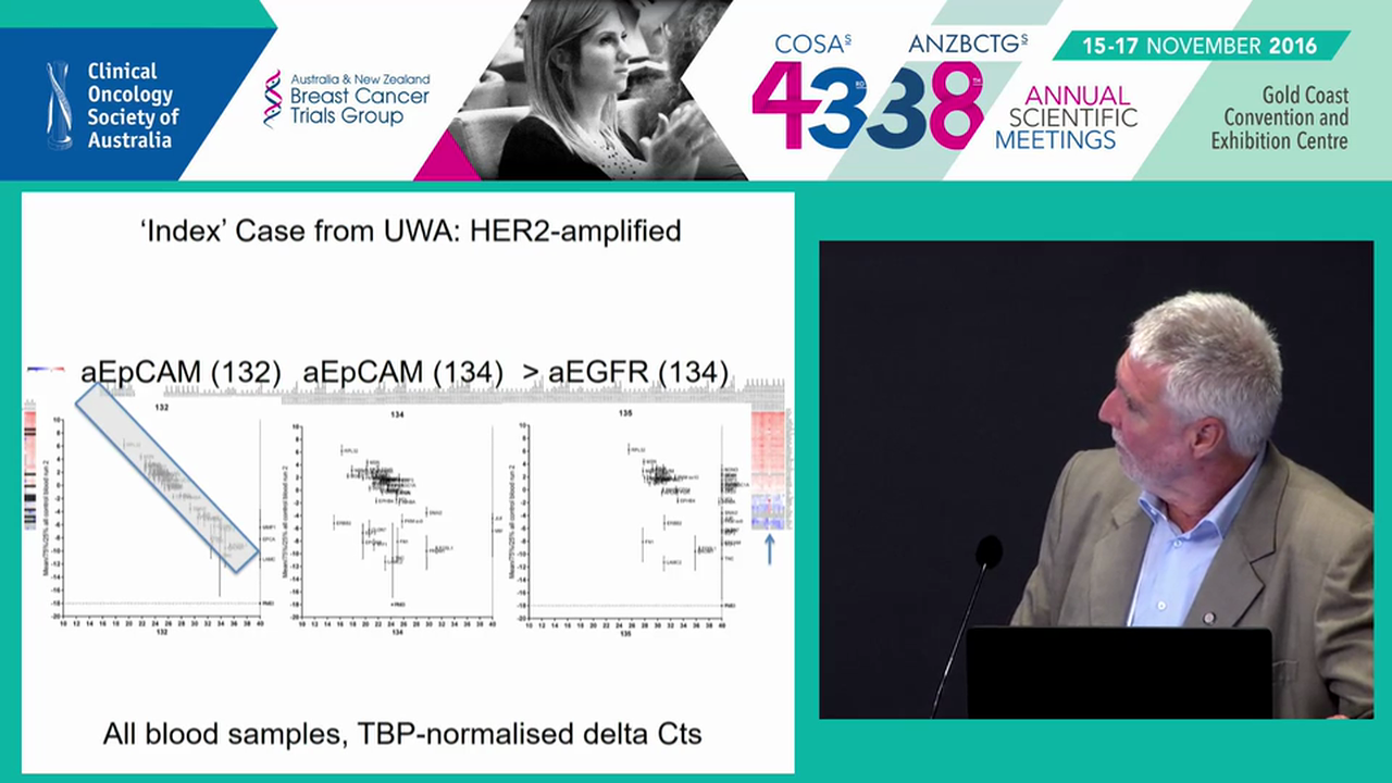 Circulating and disseminated tumour cells in breast cancer Erik (Rik) Thompson