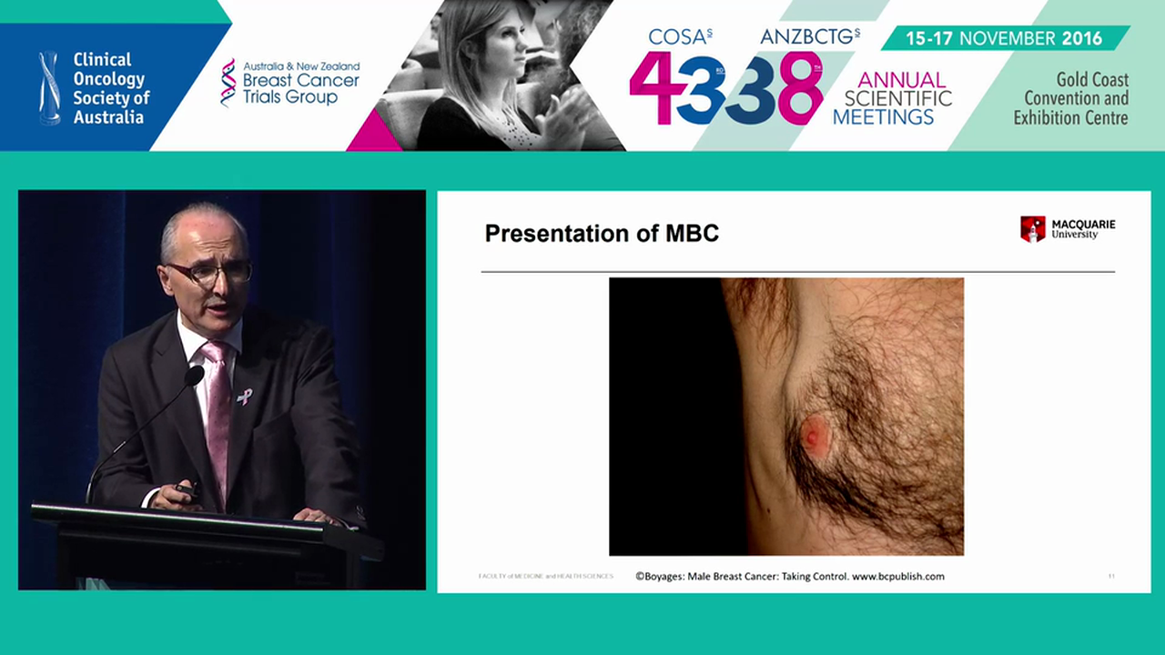Male Breast Cancer The Challenges John Boyages