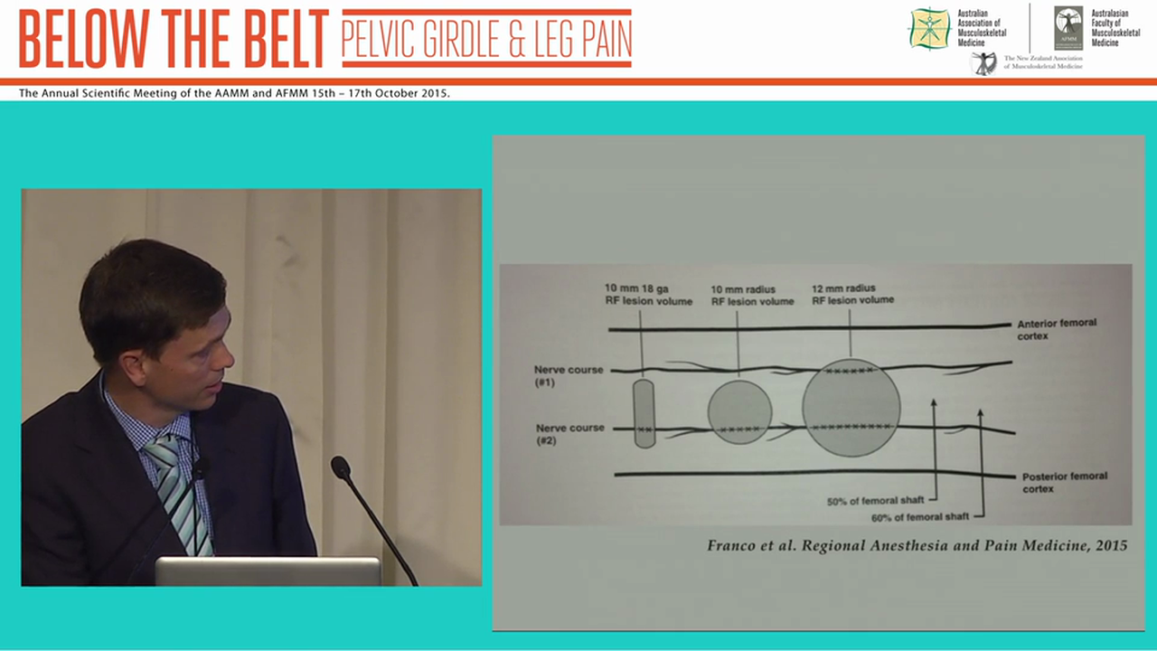 Non-surgical treatment of chronic lower limb joint pain Dr Neels du Toit