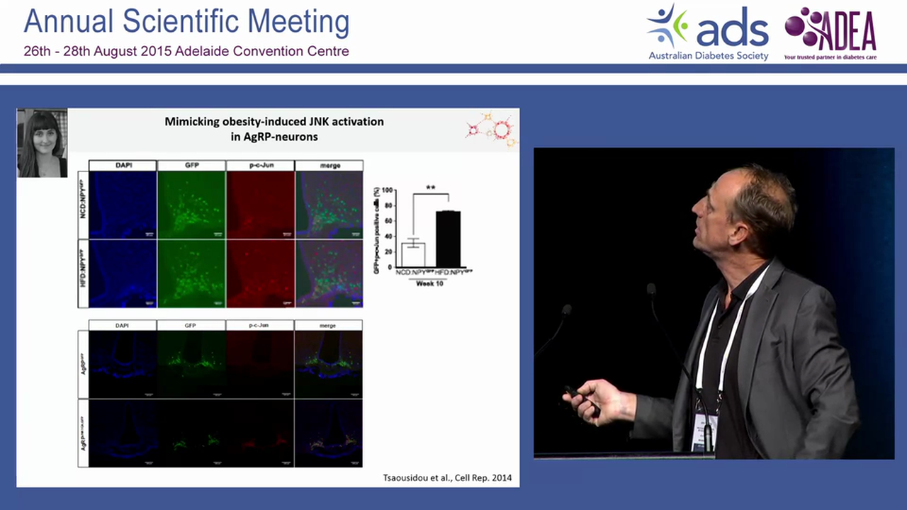 Neural control of obesity and type 2 diabetes Jens Brüning