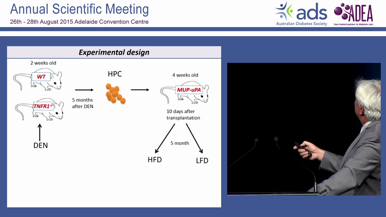 The oil that feeds the flame obesity, NASH and liver cancer Michael Karin